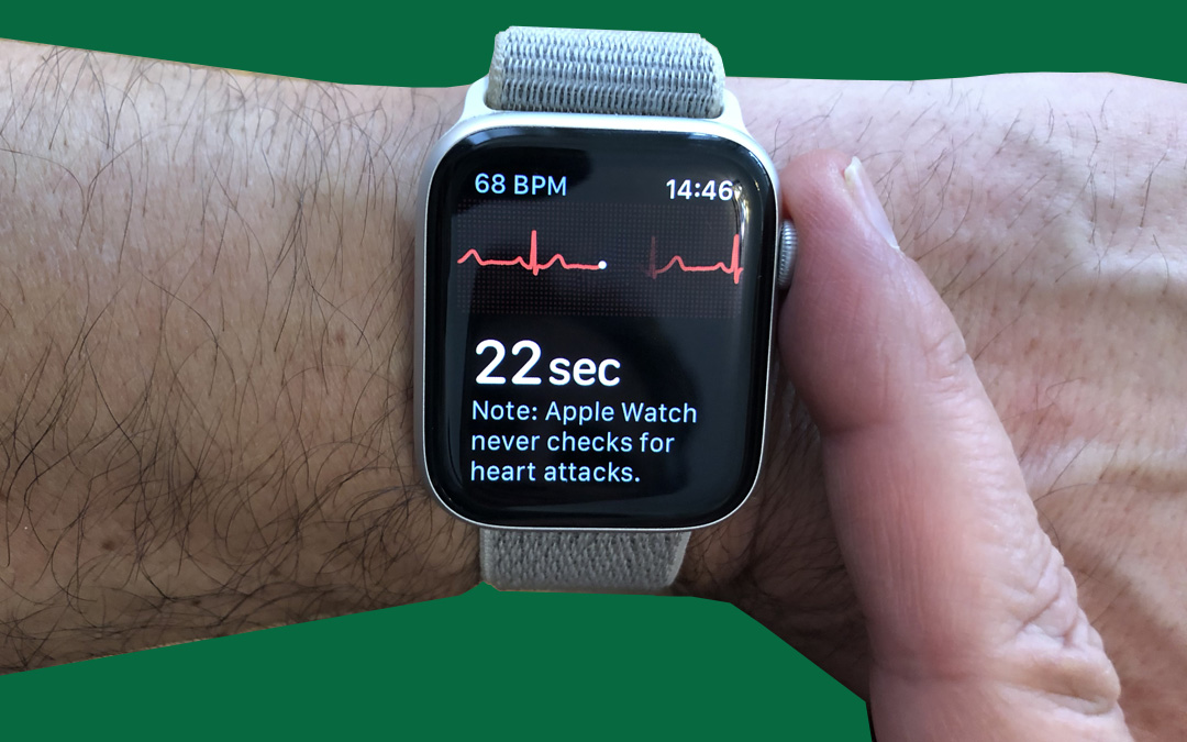ECG on the Apple Watch